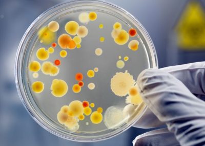 bacteria